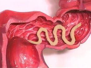 Localización en el cuerpo humano
