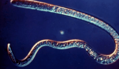 Tipos de parásitos en el cuerpo humano