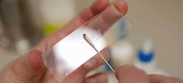 Raspado en busca de huevos de lombriz