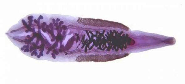 casualidad siberiana