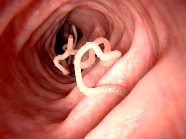parásitos en el cuerpo humano